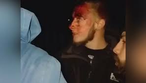 Des partisans de l’Église schismatique d’Ukraine ont blessé des fidèles montant le guet devant leur église Des partisans de l’Église schismatique d’Ukraine ont blessé des fidèles montant le guet devant leur église